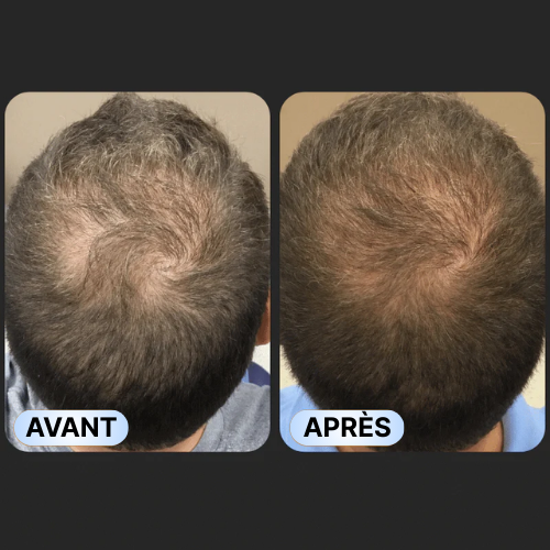 Shampooing activateur de racines