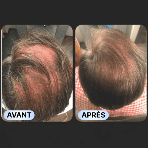 Shampooing activateur de racines