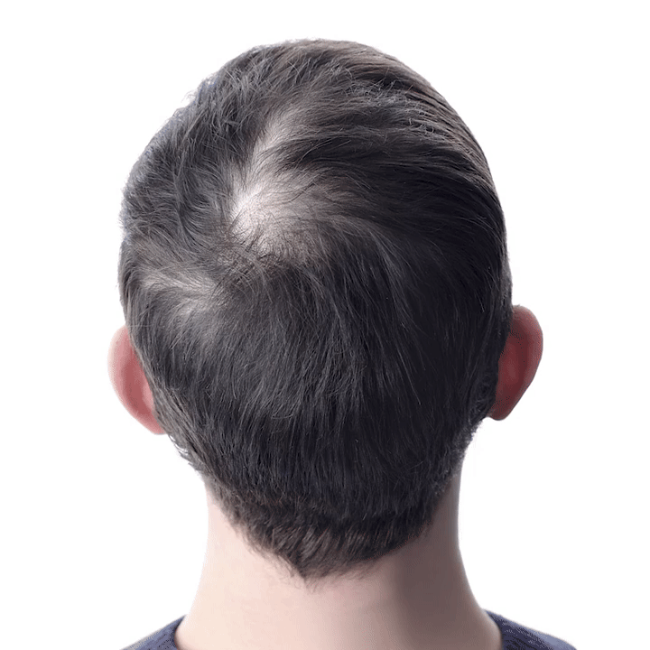 Feature product image