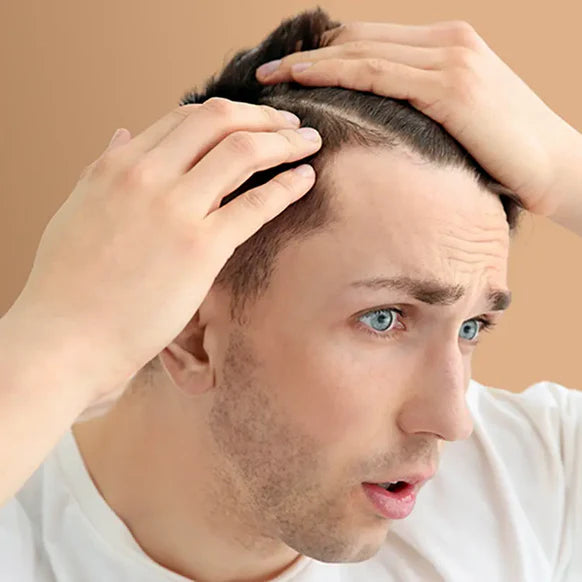 Pourquoi les hommes perdent leurs cheveux (et comment y remédier)